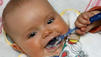 Jedes f&uuml;nfte Baby in Deutschland ist zu dick