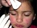 Botox-Mutter verliert Sorgerecht