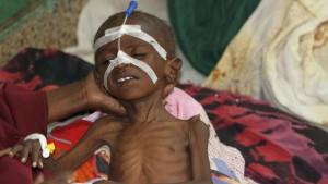 Somalia: Alle sechs Minuten stirbt ein Kind Hungersnot