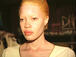 Diandra Forrest schwarze Albino