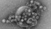 Ganze Schule dicht: Noro-Virus?