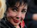 Elizabeth Taylor: Herz-Operation!