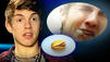 DSDS 2012: Kandidat Joey Heindle und die Lippenkillerpistazie