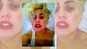 Lady GaGa twittert übles Foto nach Bühnen-Unfall Lady GaGa twittert Foto nach Bühnen-Unfall