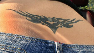 Tattoo-Entfernung: Vieles bleibt für immer Tattoo-Entfernung