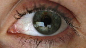 Leiden Sie am Office-Eye-Syndrom?
