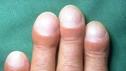 juckreiz penis nach geschlechtsverkehr erotische massage in paderborn juckreiz penis nach geschlechtsverkehr erotische massage in paderborn