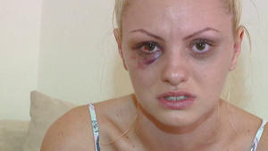 Alexandra Stan vom Freund verprügelt